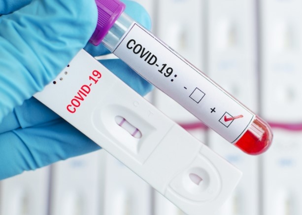 313 са новите случаи на COVID 19 у нас Това е